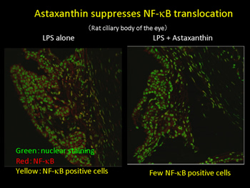 Astaxanthin suppressed NF-kB translocation in endotoxin-induced uveitis in rats